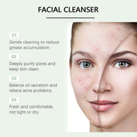 Daily Facial Cleanser for Gentle Skin Care